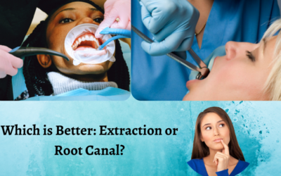 Which is Better: Tooth Extraction or Root Canal?